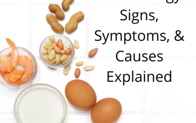 Food Allergy Signs, Symptoms, and Causes Explained