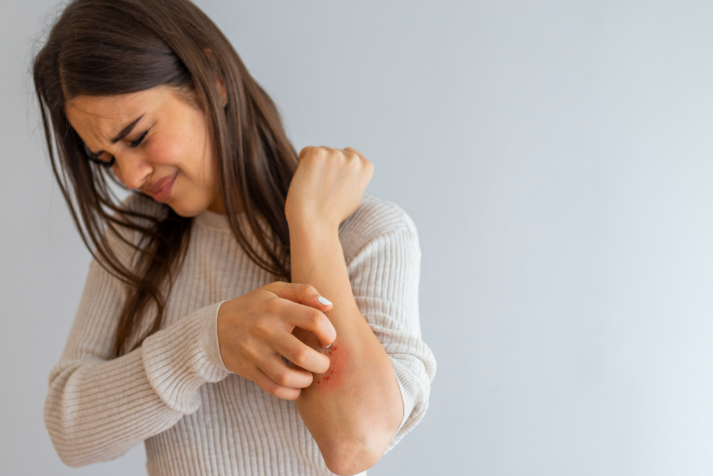 How is Eczema Related to the Gut? AZ Dietitians