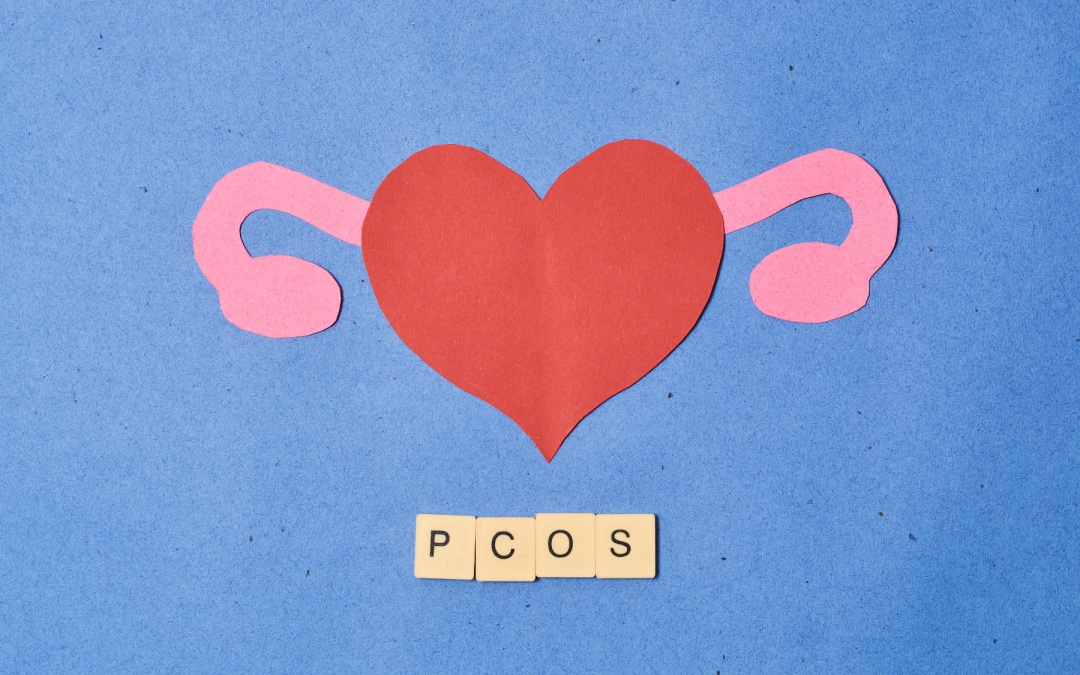 Nutrition and PCOS